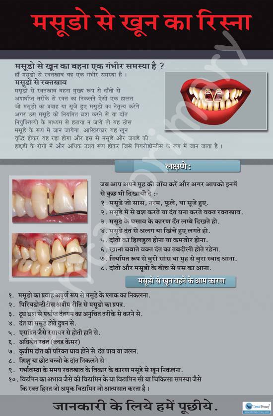 dental care essay in hindi