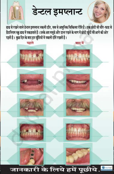 dental care essay in hindi